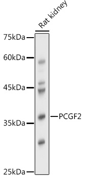 PCGF2 Rabbit Polyclonal Antibody