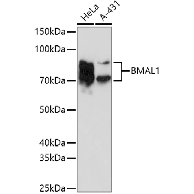 BMAL1 Rabbit Polyclonal Antibody