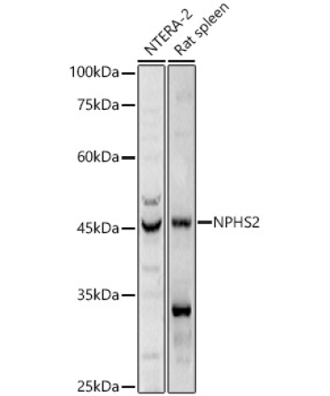 NPHS2 Rabbit Polyclonal Antibody