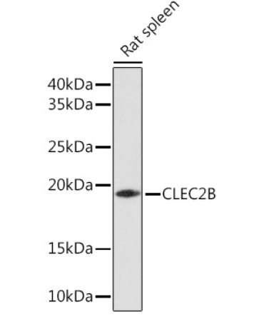 CLEC2B Rabbit Polyclonal Antibody