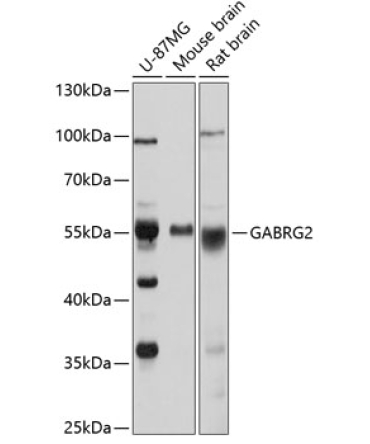 GABRG2 Rabbit Polyclonal Antibody