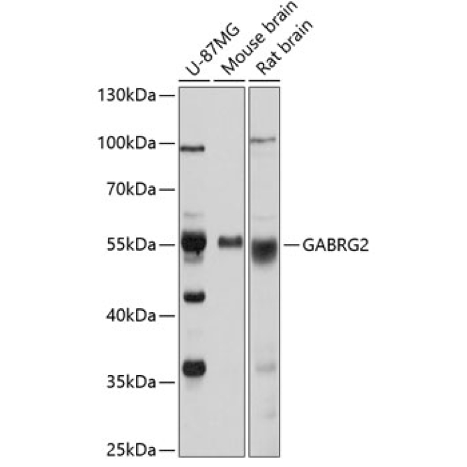 GABRG2 Rabbit Polyclonal Antibody