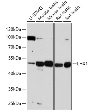 LHX1 Rabbit Polyclonal Antibody