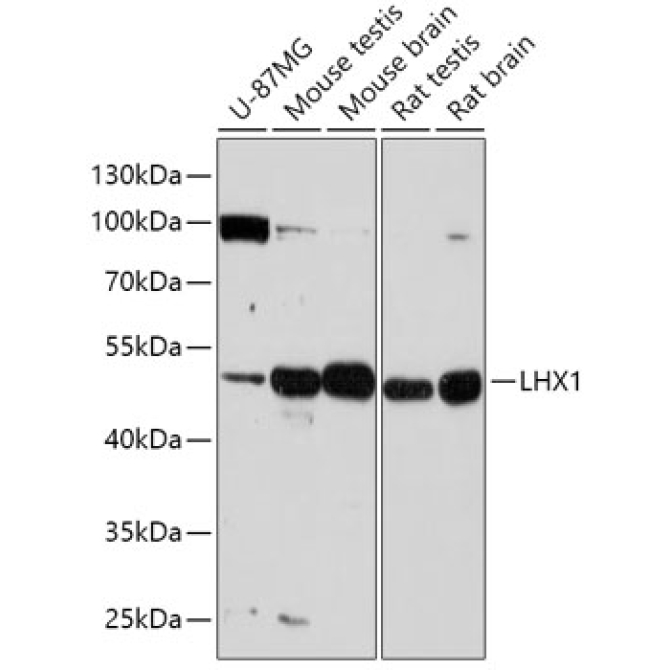 LHX1 Rabbit Polyclonal Antibody