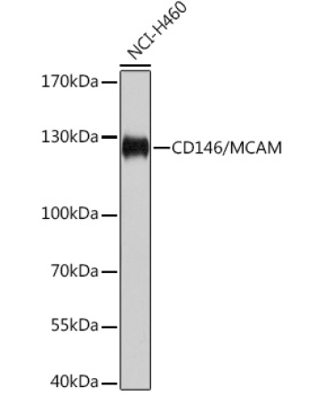 CD146/MCAM Rabbit Polyclonal Antibody