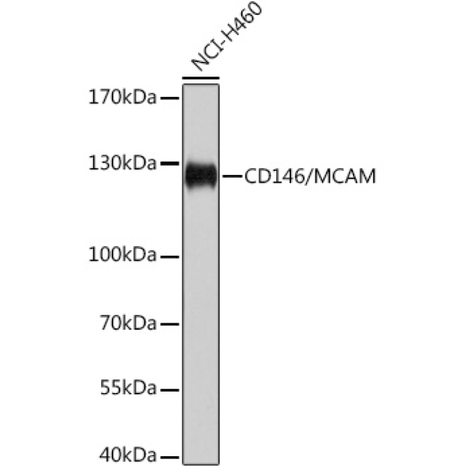CD146/MCAM Rabbit Polyclonal Antibody