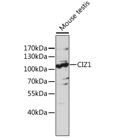 CIZ1 Rabbit Polyclonal Antibody