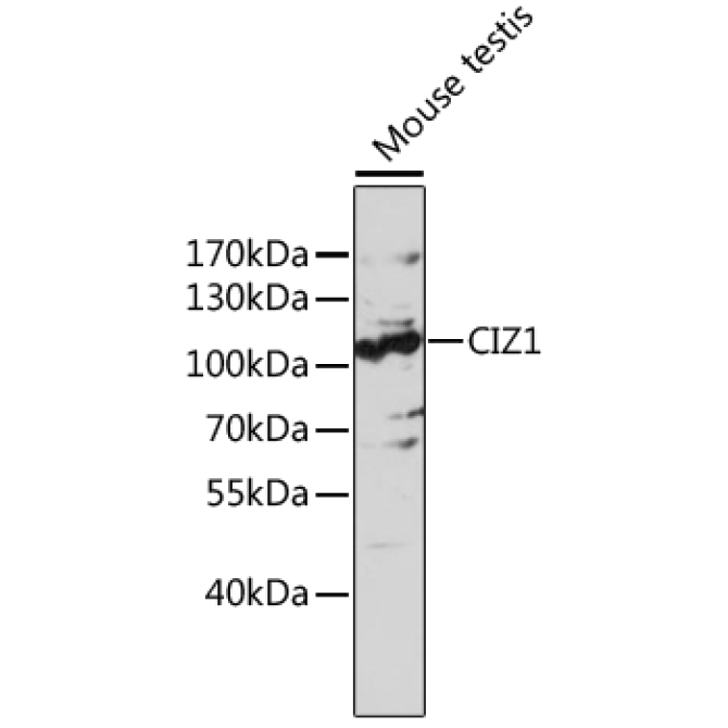 CIZ1 Rabbit Polyclonal Antibody