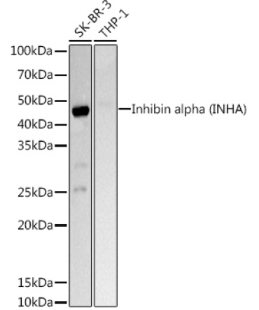 Inhibin alpha (INHA) Rabbit Polyclonal Antibody