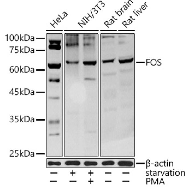FOS Rabbit Polyclonal Antibody