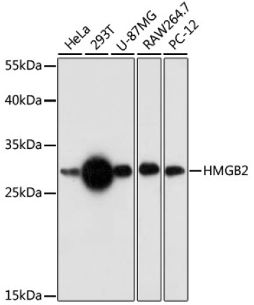 HMGB2 Rabbit Polyclonal Antibody