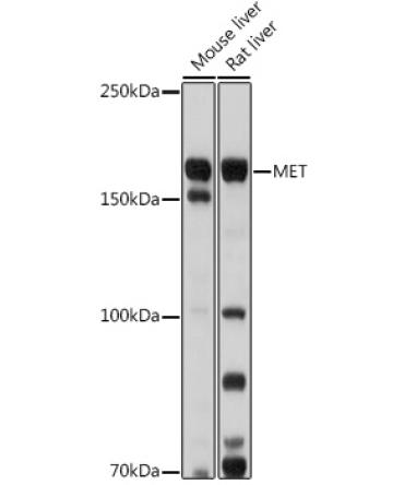 MET Rabbit Polyclonal Antibody