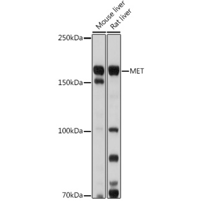 MET Rabbit Polyclonal Antibody