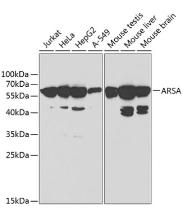 ARSA Rabbit Polyclonal Antibody