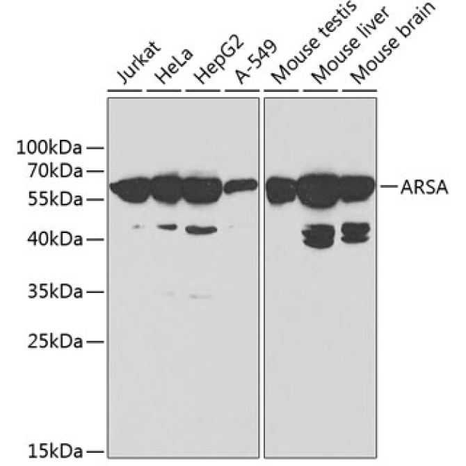ARSA Rabbit Polyclonal Antibody
