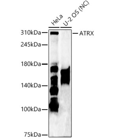ATRX Rabbit Polyclonal Antibody
