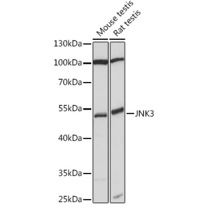JNK3 Rabbit Polyclonal Antibody
