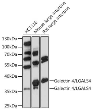 Galectin 4/LGALS4 Rabbit Polyclonal Antibody
