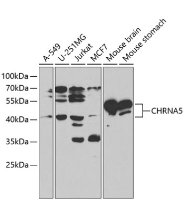 CHRNA5 Rabbit Polyclonal Antibody