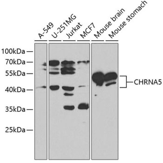 CHRNA5 Rabbit Polyclonal Antibody