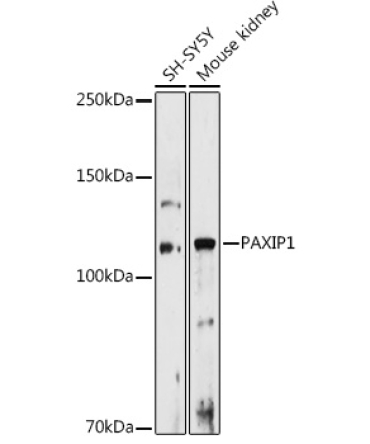 PAXIP1 Rabbit Polyclonal Antibody