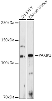 PAXIP1 Rabbit Polyclonal Antibody