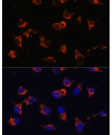 CA19-9 Mouse Monoclonal Antibody