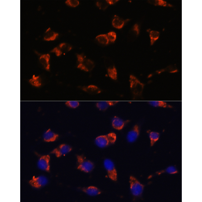 CA19-9 Mouse Monoclonal Antibody