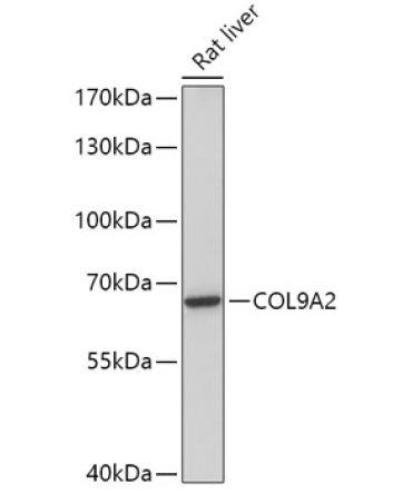 COL9A2 Rabbit Polyclonal Antibody