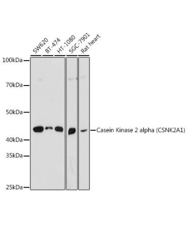 Casein Kinase 2 alpha (CSNK2A1) Rabbit Polyclonal Antibody