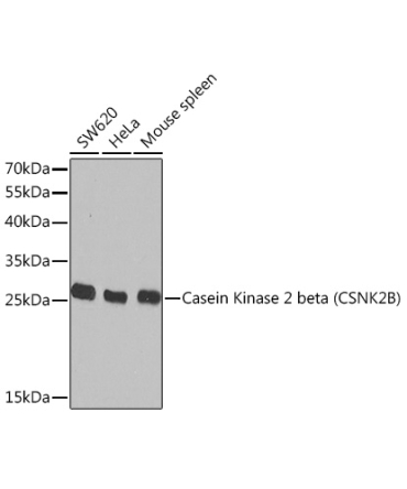Casein Kinase 2 beta (CSNK2B) Rabbit Polyclonal Antibody