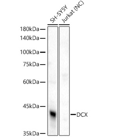 Doublecortin Rabbit Polyclonal Antibody