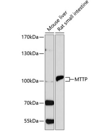MTTP Rabbit Polyclonal Antibody