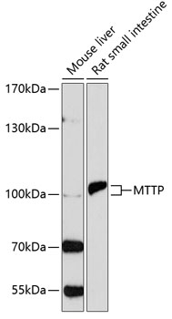 MTTP Rabbit Polyclonal Antibody