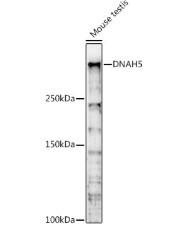 DNAH5 Rabbit Polyclonal Antibody