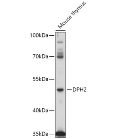 DPH2 Rabbit Polyclonal Antibody