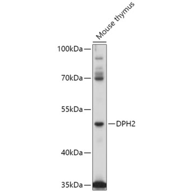 DPH2 Rabbit Polyclonal Antibody