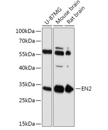 EN2 Rabbit Polyclonal Antibody