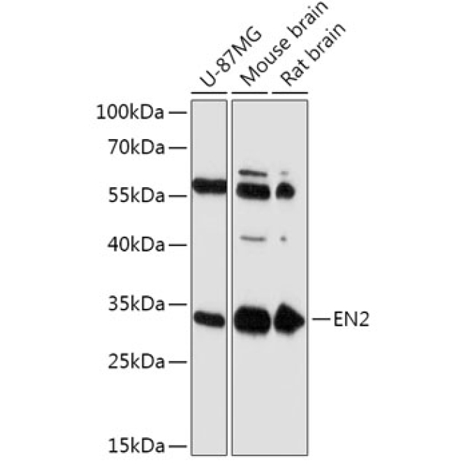 EN2 Rabbit Polyclonal Antibody