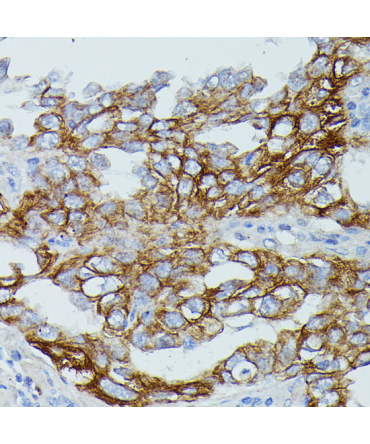 FCGR1B Rabbit Polyclonal Antibody