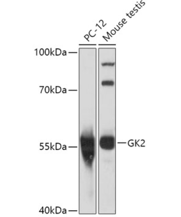 GK2 Rabbit Polyclonal Antibody
