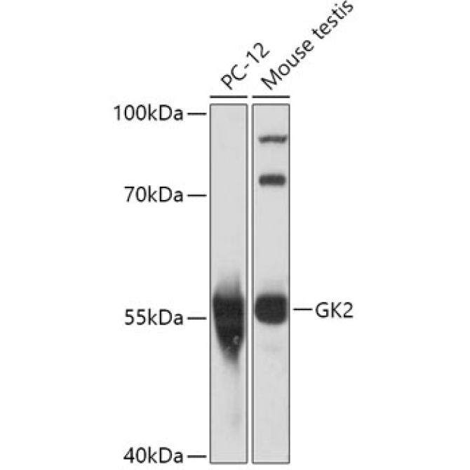 GK2 Rabbit Polyclonal Antibody