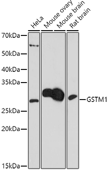 GSTM1 Rabbit Polyclonal Antibody