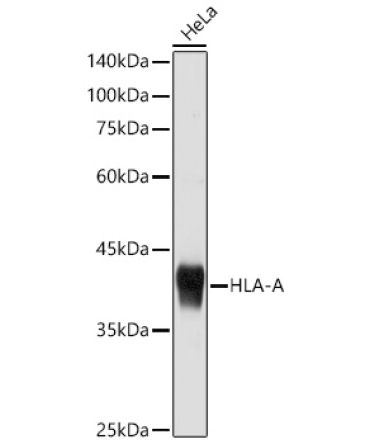 HLA-A+HLA-B+HLA-C Rabbit Polyclonal Antibody