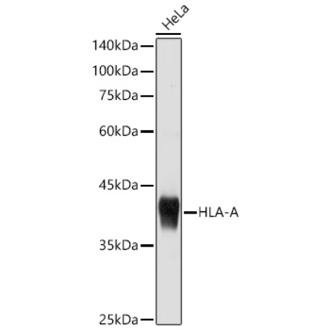 HLA-A+HLA-B+HLA-C Rabbit Polyclonal Antibody