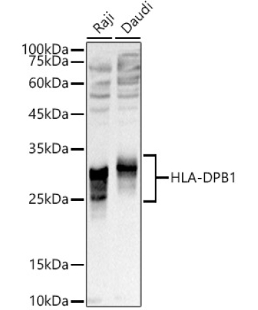 HLA-DPB1 Rabbit Polyclonal Antibody