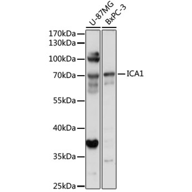 ICA1 Rabbit Polyclonal Antibody