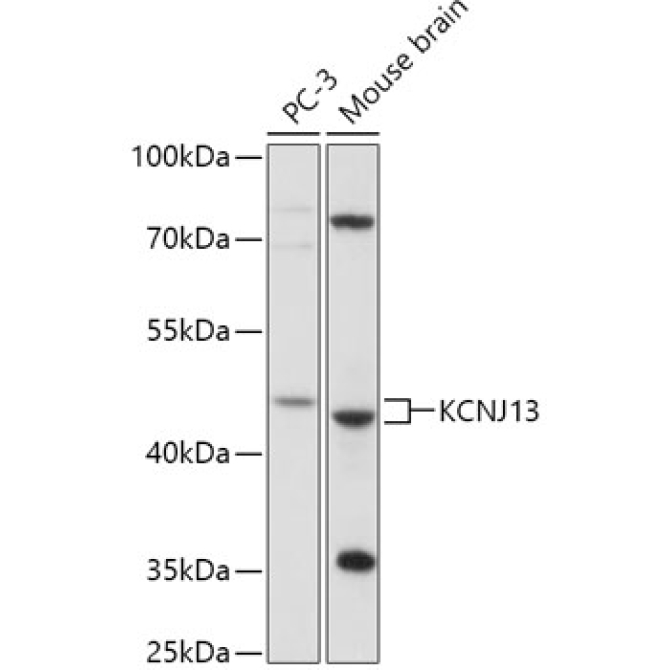 KCNJ13 Rabbit Polyclonal Antibody