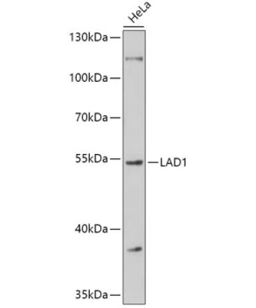 LAD1 Rabbit Polyclonal Antibody