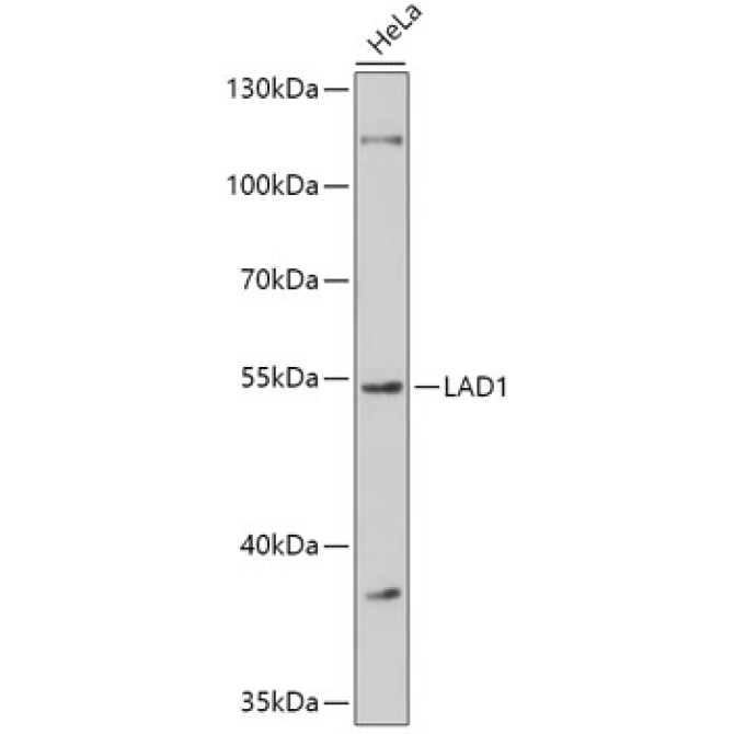 LAD1 Rabbit Polyclonal Antibody